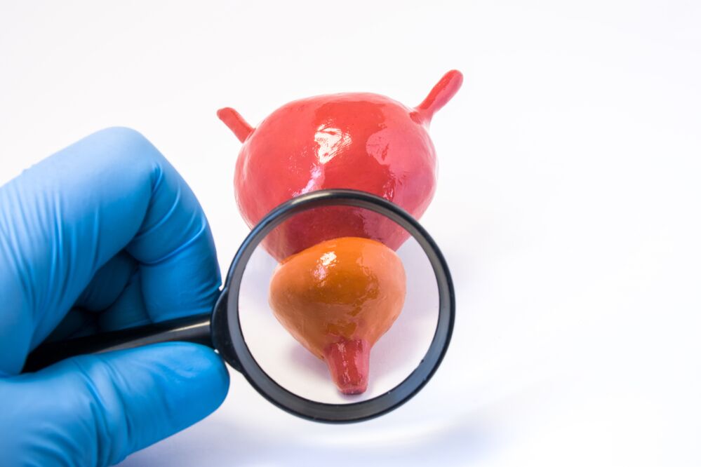 Adénome de la prostate : causes, symptômes et prévention - Men's Defence